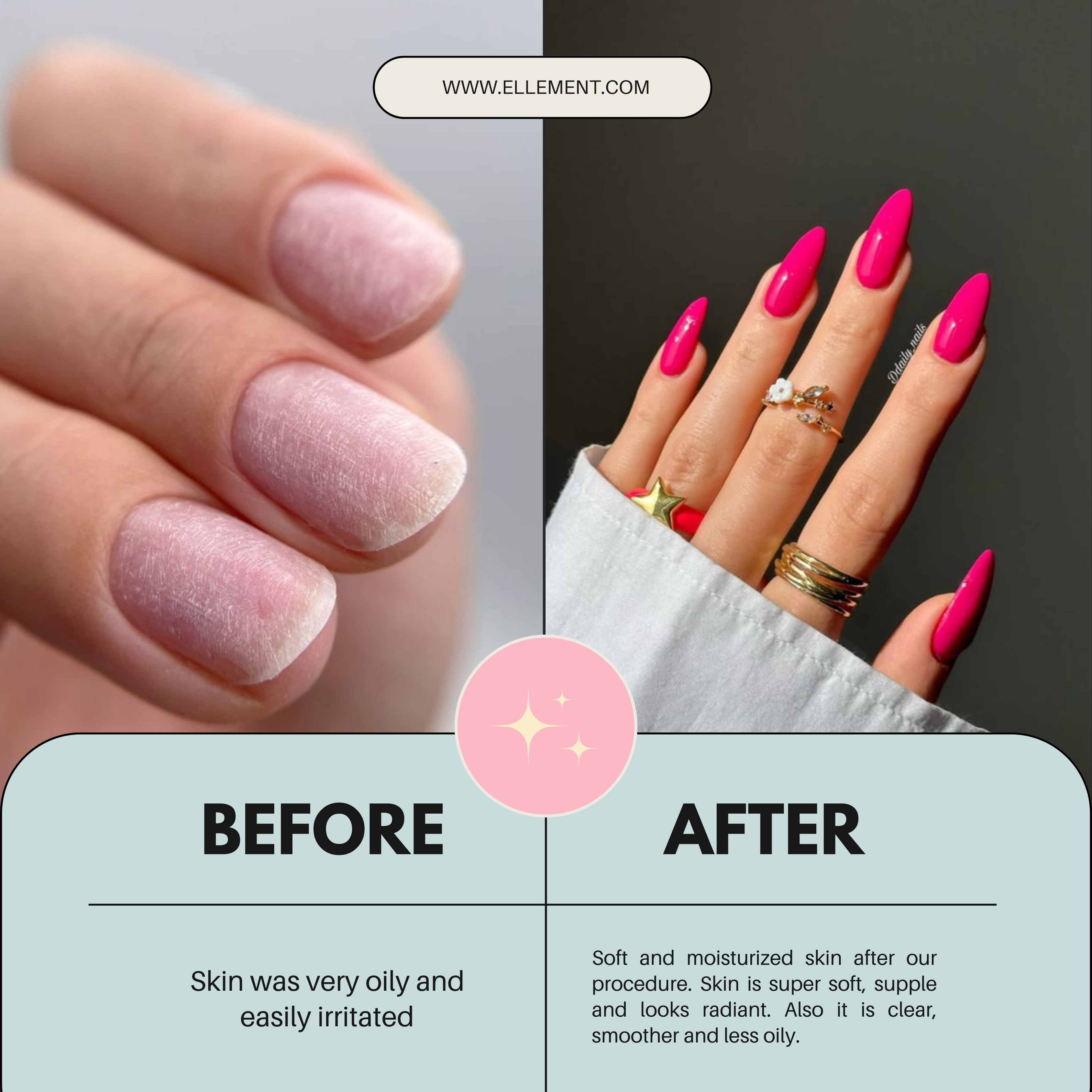 Flamingo Hot Pink Coloured Acrylic Powder for Nail Extensions and Overlays – Professional Acrylic Nail Powder for Long-Lasting Results